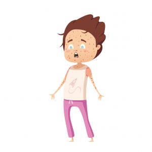 MMR symptoms web chn-01 麻疹