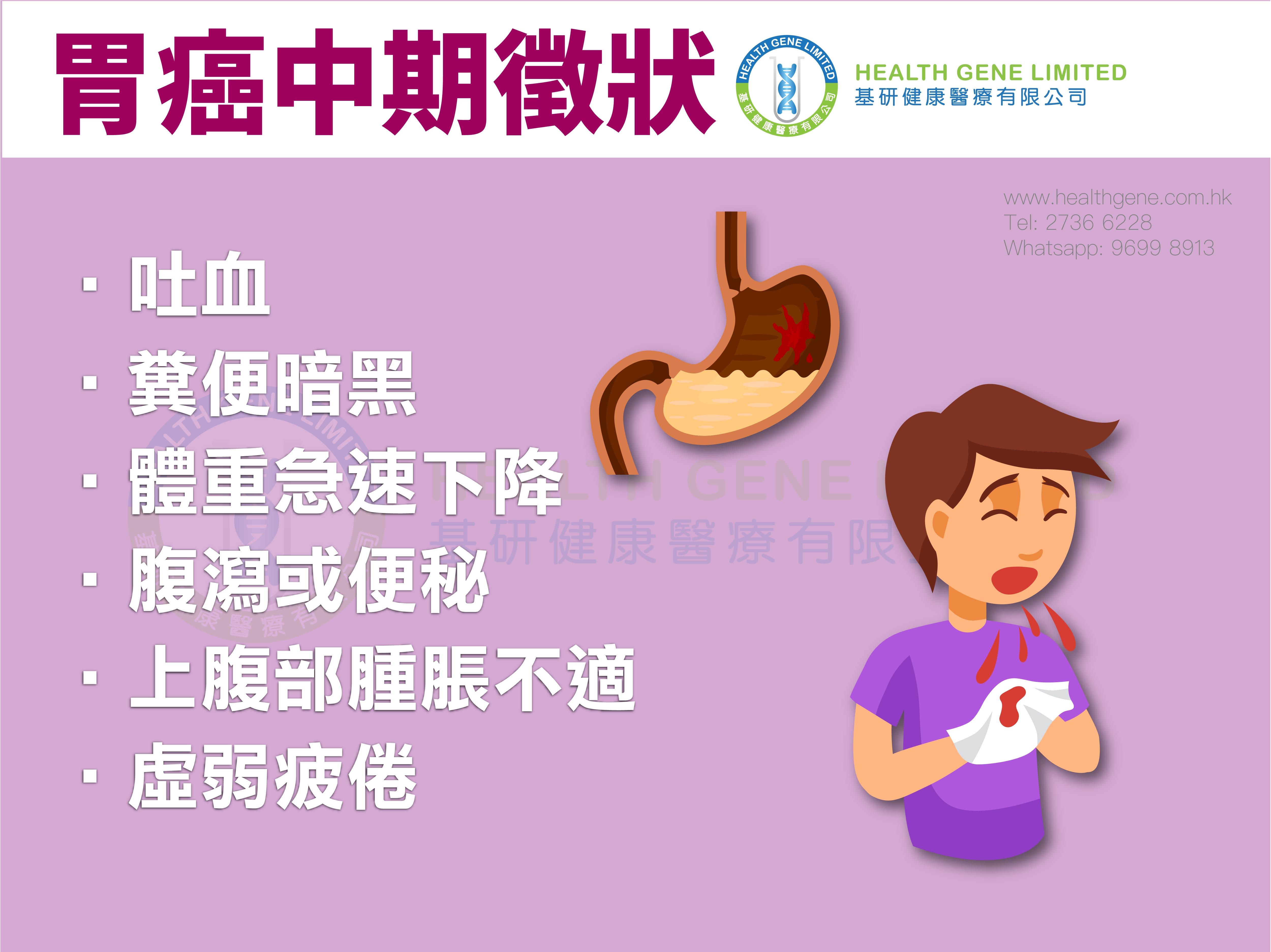 Stomach cancer web post 2-02
