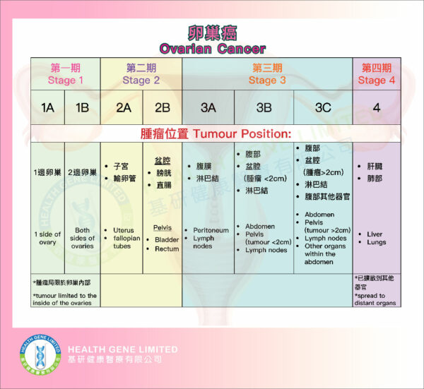 Ovarian Cancer stages